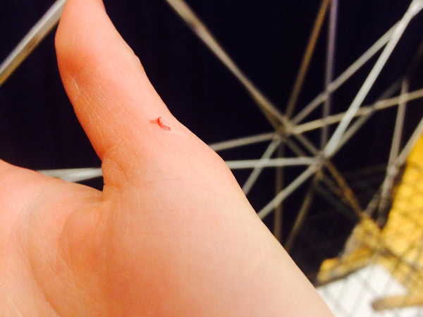 My Recent Parrot Bite